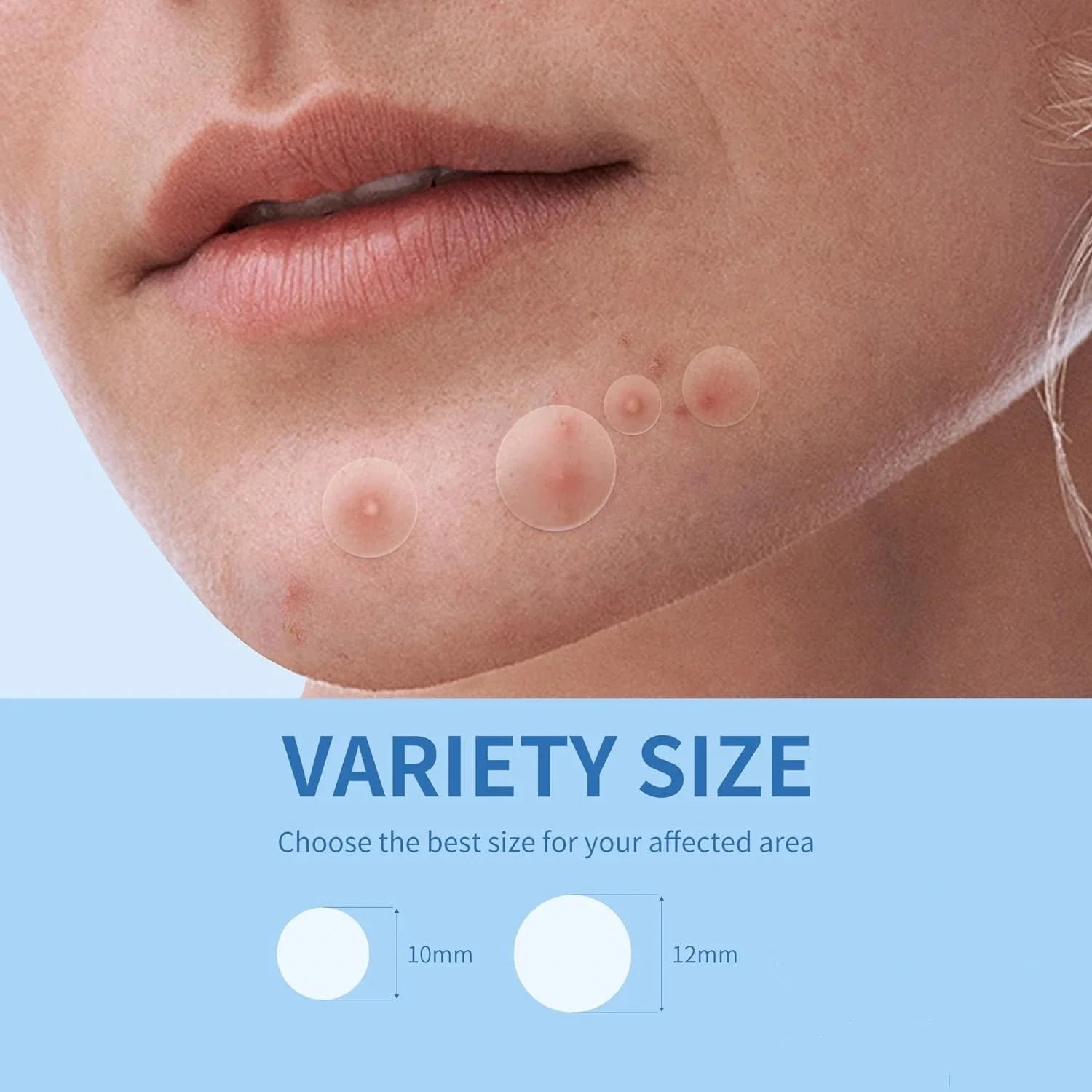Invisible Acne Veneer Lump Sticker